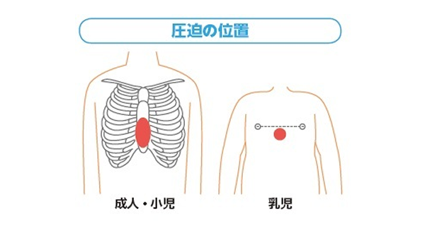 圧迫の位置